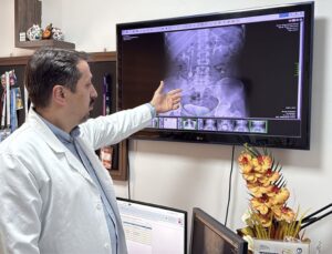 İdrar kanalından çıkan 51 taş, doktorları bile şaşkına çevirdi