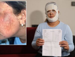 Prenses cilt bakımı yüzünü yaktı: Oğlum "öcü" deyip benden kaçıyor